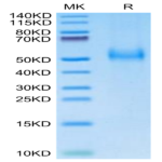 Human uPAR/PLAUR Protein (PAR-HM401)
