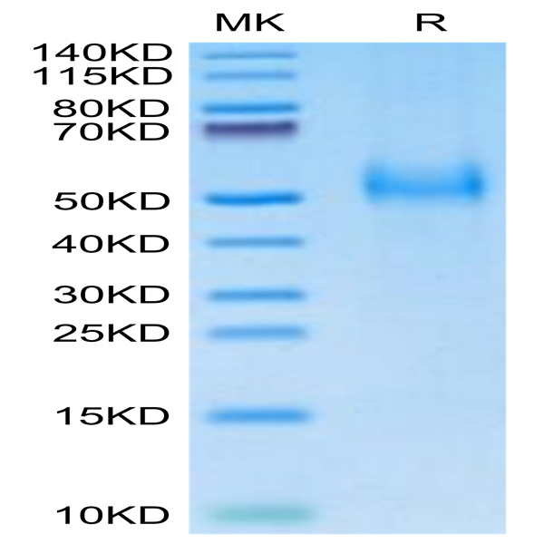 Human uPAR/PLAUR Protein (PAR-HM401)