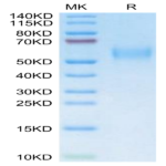 Mouse uPAR/PLAUR isoform 1 Protein (PAR-MM401)