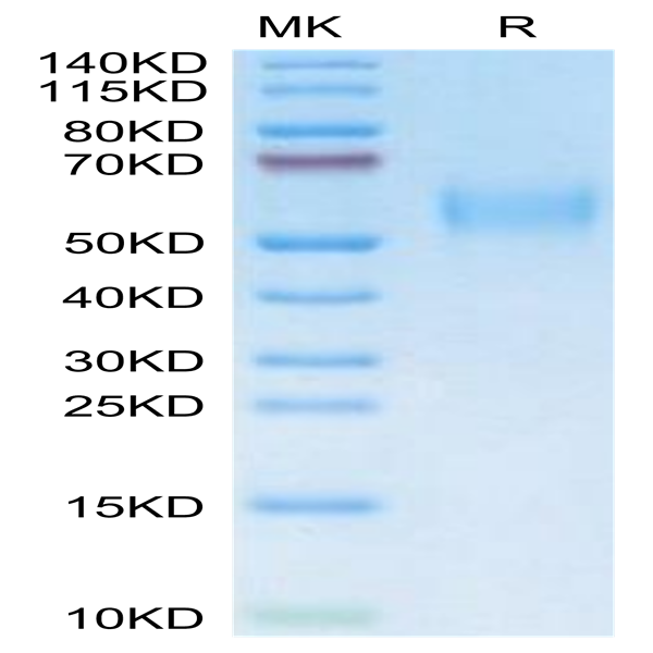 Mouse uPAR/PLAUR isoform 1 Protein (PAR-MM401)
