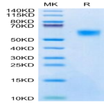 Biotinylated Mouse uPAR/PLAUR Protein (PAR-MM401B)