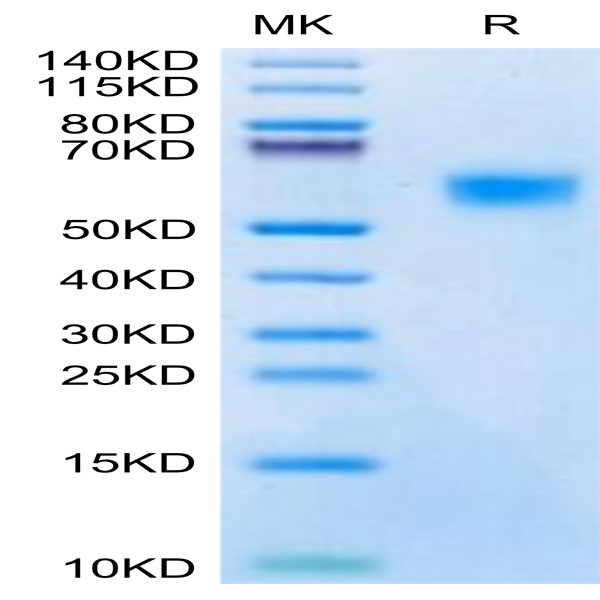 Biotinylated Mouse uPAR/PLAUR Protein (PAR-MM401B)