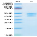 Human PSCA Protein (PCA-HM201)