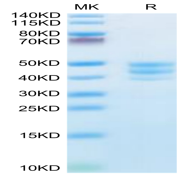 Human PSCA Protein (PCA-HM201)