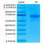 Human PD-1/PDCD1 Protein (PD1-HM201)