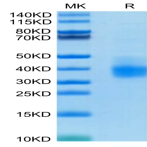 Human PD-L1/B7-H1 Protein (PDL-HM110)
