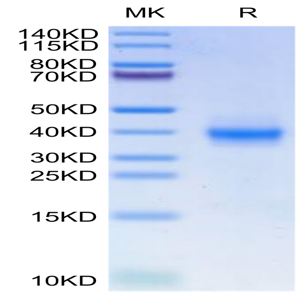 Human PD-L1/B7-H1 Protein (PDL-HM11D)
