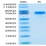 Human PD-L1/B7-H1 Protein (PDL-HM210)