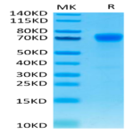 Human PD-L1/B7-H1 Protein (PDL-HM310)