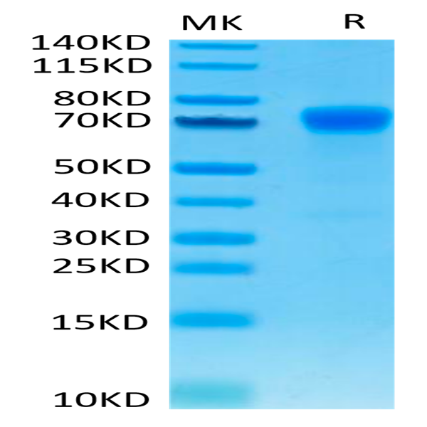 Human PD-L1/B7-H1 Protein (PDL-HM310)