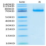 Mouse PD-L1/B7-H1 Protein (PDL-MM210)