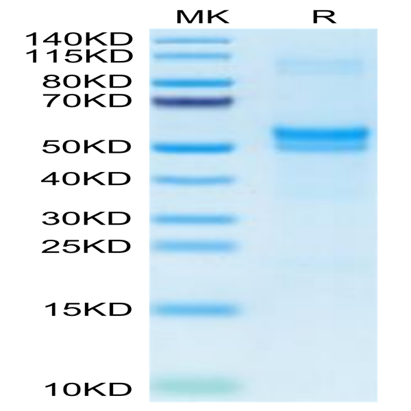 Human PDGFD Protein (PGD-HM101)