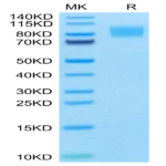 Cynomolgus PDGF R beta/CD140b Protein (PGF-CM1RB)