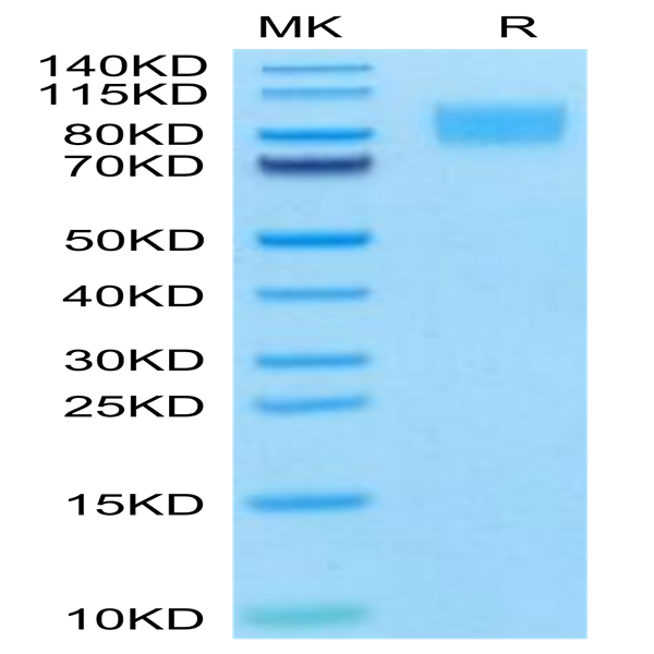 Cynomolgus PDGF R beta/CD140b Protein (PGF-CM1RB)