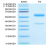 Mouse PGF Protein (PGF-MM201)