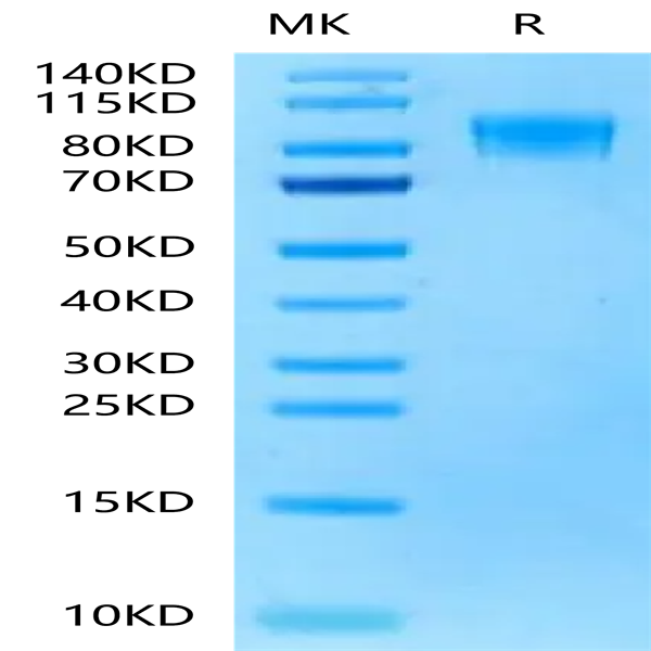 Rat PDGF R beta/CD140b Protein (PGF-RM1RB)