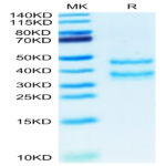 Mouse PK-1/PROK1 Protein BP004451 Syd Labs