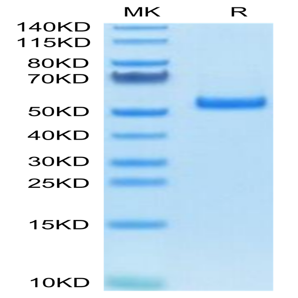 Human PLAU/uPA Protein (pro form) (PLA-HM102)