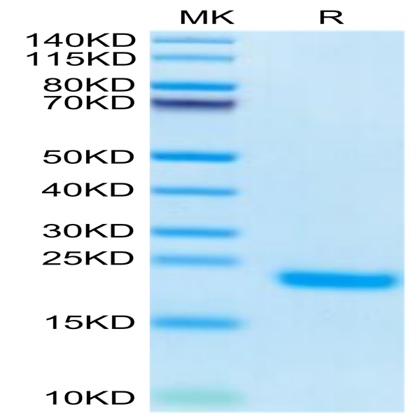 Human PLA2G1B Protein (PLA-HM11B)