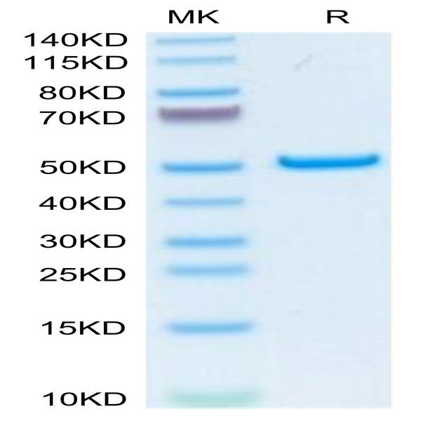 Human PLA2G1B Protein (PLA-HM21B)