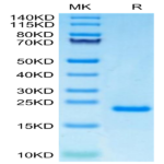 Human PRL-1/PTP4A1 Protein (PRL-HE101)