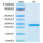 Human PS20 Protein BP004502 Syd Labs