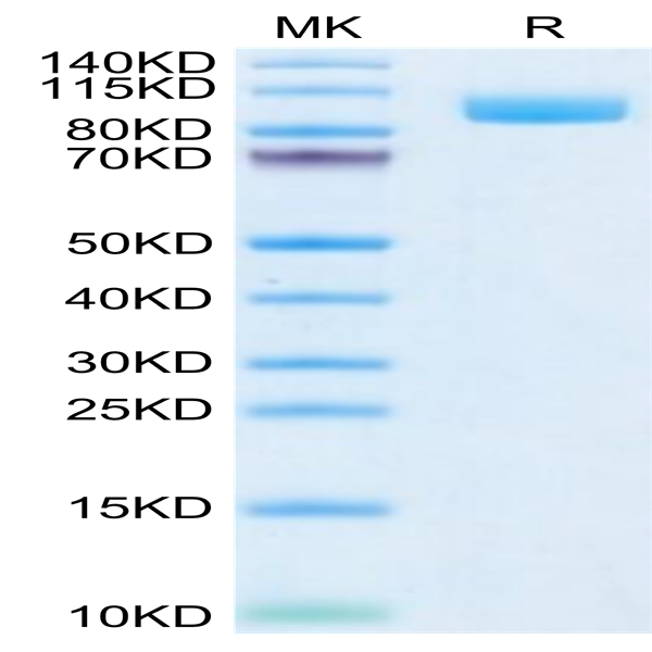 Biotinylated Cynomolgus PSMA/FOLH1 Protein (Primary Amine Labeling) (PSM-CM110B)