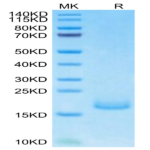 Human PSMP Protein BP004453 Syd Labs