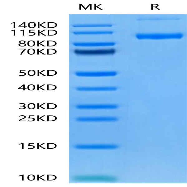 Human PSMA/FOLH1 Protein (PSM-HM110)