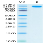 Human PSMA/FOLH1 Protein (PSM-HM210)