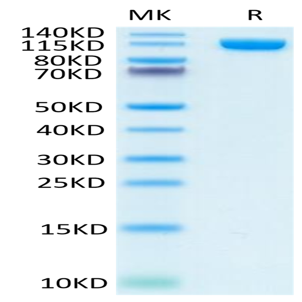 Human PSMA/FOLH1 Protein (PSM-HM210)