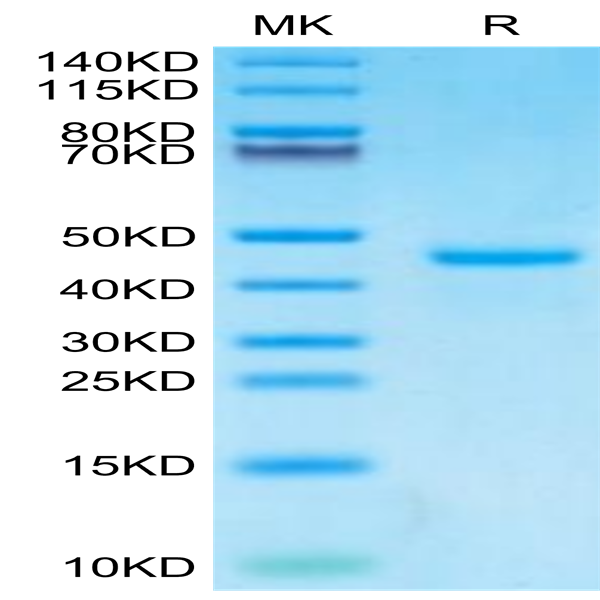 Human PTH Protein (PTH-HM201)
