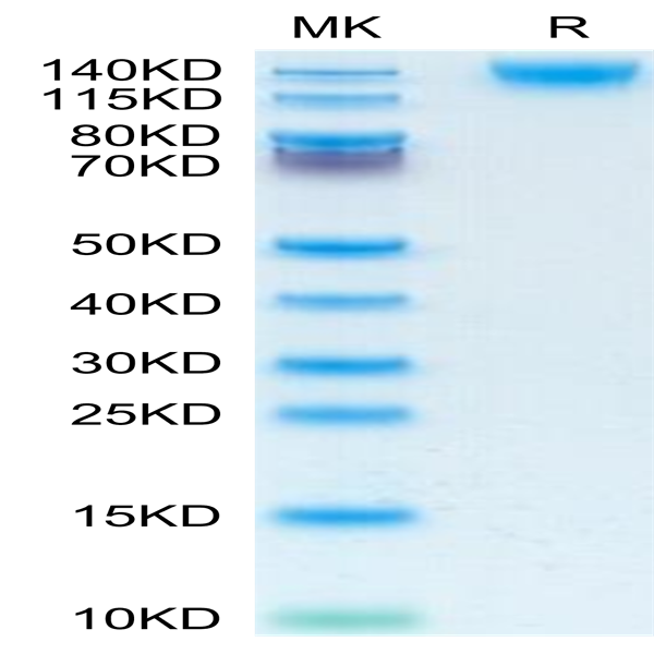 Human CD45/PTPRC Protein (PTP-HM104)