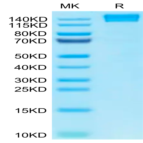 Human CD45/PTPRC Protein (PTP-HM204)