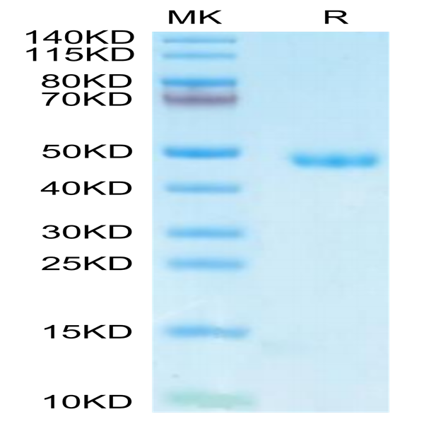 Mouse AGER Protein (RAG-MM10E)