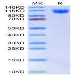 Human RET Protein (RET-HM101)