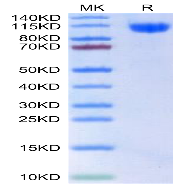 Human RET Protein (RET-HM101)