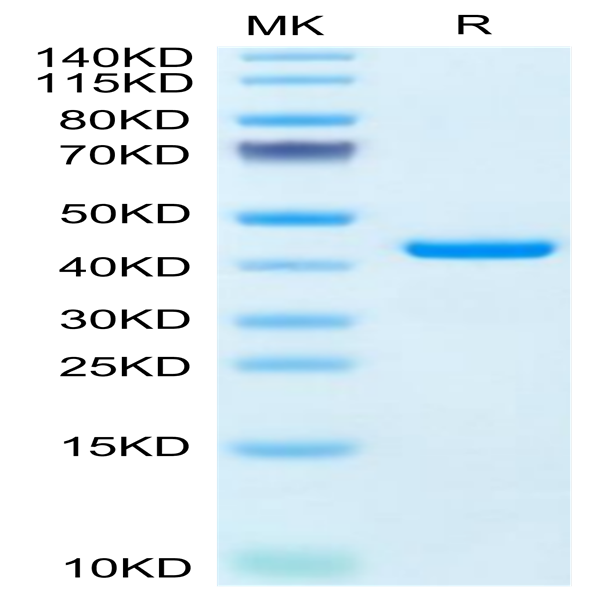 Human RETN Protein (RET-HM201)