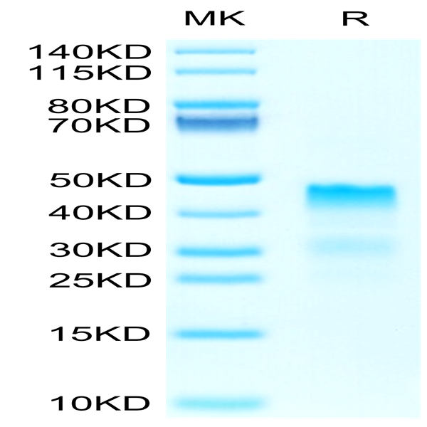 Biotinylated Human RGMa Protein (RGM-HM401B)
