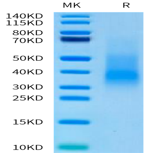 Human RANKL/TNFSF11/CD254 Protein (RKL-HM001)