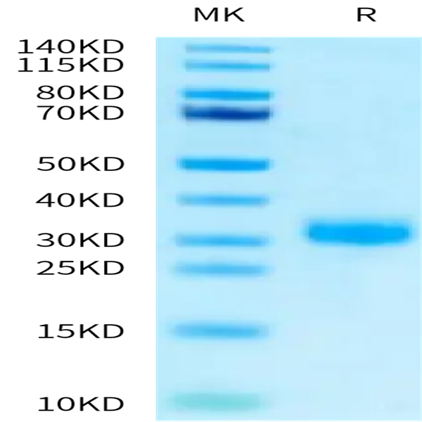 Human RNF43 Protein (RNF-HM143)