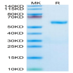 Human RNF43 Protein (RNF-HM234)