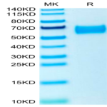 Human ROBO4 Protein (ROB-HM104)