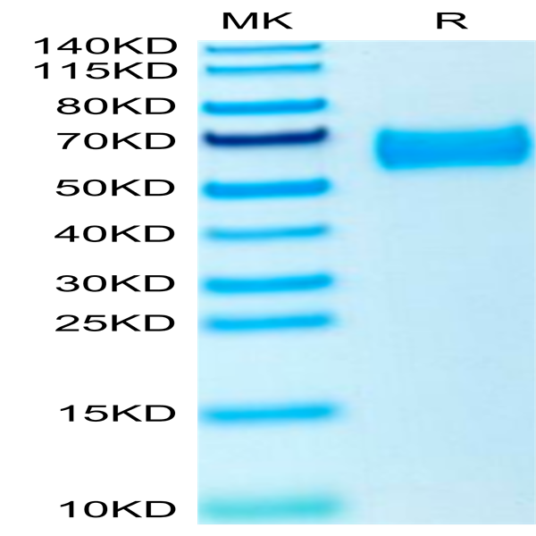 Human ROBO4 Protein (ROB-HM104)