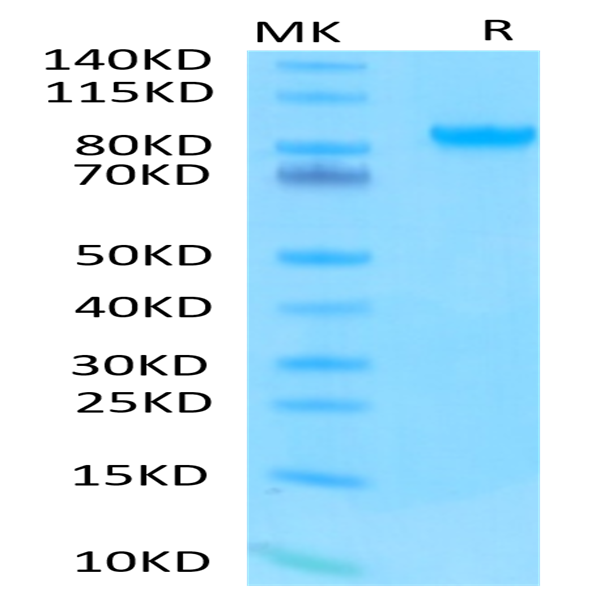 Human/Cynomolgus/Rhesus macaque ROR1 Protein (ROR-HM201)