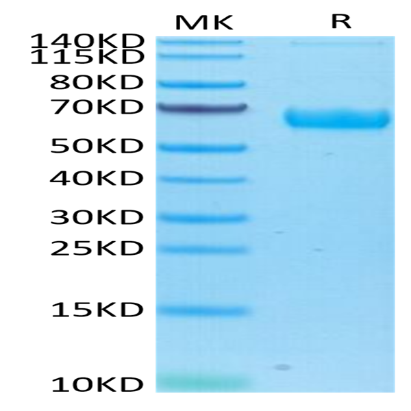 Human/Cynomolgus/Rhesus macaque ROR1 Protein (ROR-HM401)