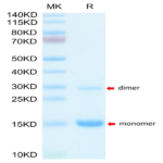 Mouse S100A9/MRP14 Protein BP004609 Syd Labs