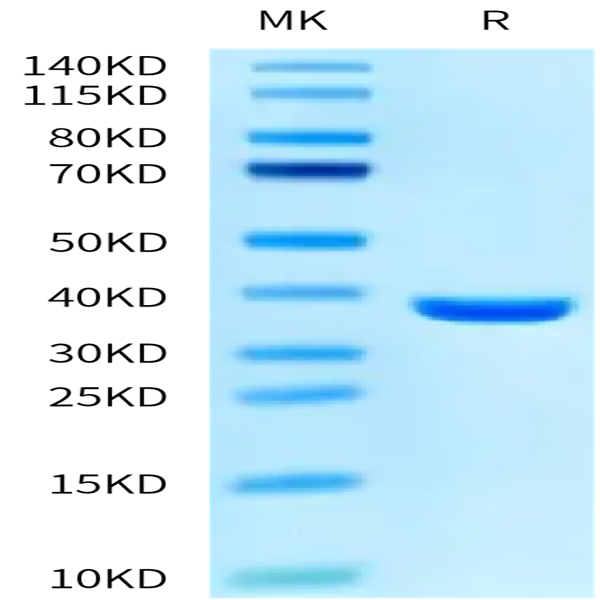 SARS PLpro/papain-like protease Protein (SAR-VE101)
