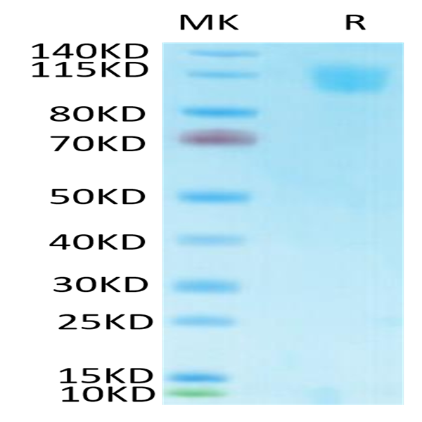Biotinylated SARS Spike S1 Protein (SAR-VM4S1B)