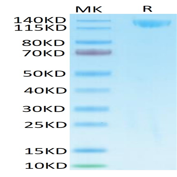SARS Spike S1 Protein (SAR-VM5S1)